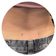 Microdermal en Titanium Deusto Bilbao con pieza visible anclada en superficie de la piel